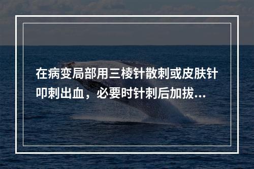 在病变局部用三棱针散刺或皮肤针叩刺出血，必要时针刺后加拔火