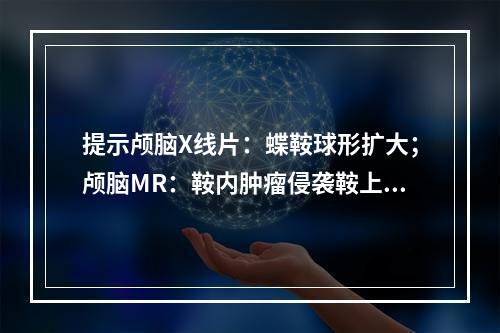 提示颅脑X线片：蝶鞍球形扩大；颅脑MR：鞍内肿瘤侵袭鞍上(下