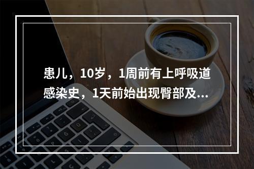 患儿，10岁，1周前有上呼吸道感染史，1天前始出现臀部及双下