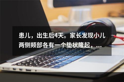 患儿，出生后4天。家长发现小儿两侧颊部各有一个垫状隆起，可活