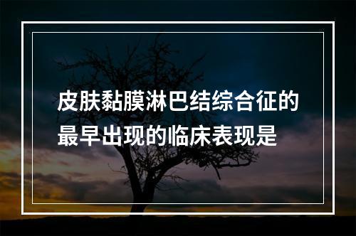 皮肤黏膜淋巴结综合征的最早出现的临床表现是