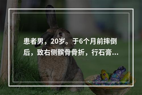 患者男，20岁。于6个月前摔倒后，致右侧髌骨骨折，行石膏外