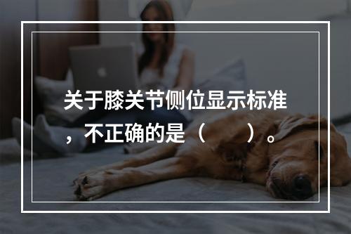 关于膝关节侧位显示标准，不正确的是（　　）。