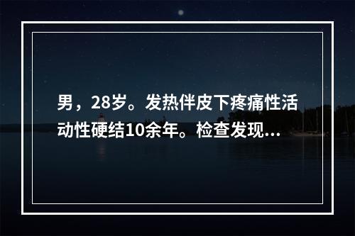 男，28岁。发热伴皮下疼痛性活动性硬结10余年。检查发现左胸