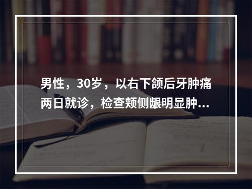 男性，30岁，以右下颌后牙肿痛两日就诊，检查颊侧龈明显肿胀