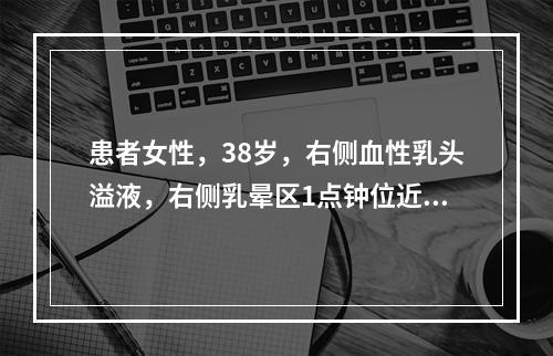 患者女性，38岁，右侧血性乳头溢液，右侧乳晕区1点钟位近乳头