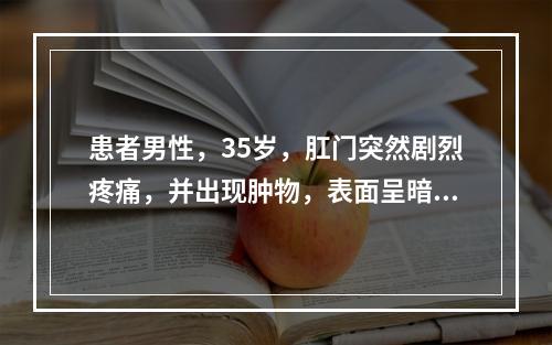 患者男性，35岁，肛门突然剧烈疼痛，并出现肿物，表面呈暗紫色