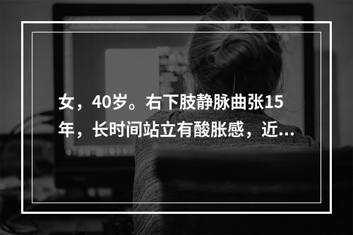 女，40岁。右下肢静脉曲张15年，长时间站立有酸胀感，近2年