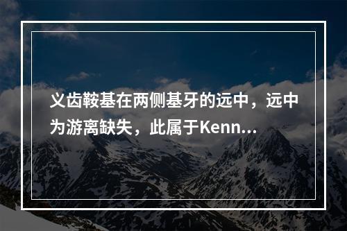 义齿鞍基在两侧基牙的远中，远中为游离缺失，此属于Kenned