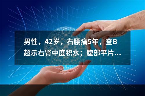 男性，42岁，右腰痛5年，查B超示右肾中度积水；腹部平片可见