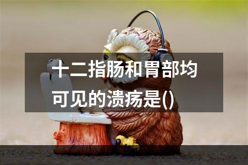 十二指肠和胃部均可见的溃疡是()