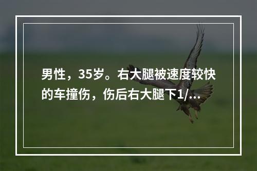 男性，35岁。右大腿被速度较快的车撞伤，伤后右大腿下1/3向