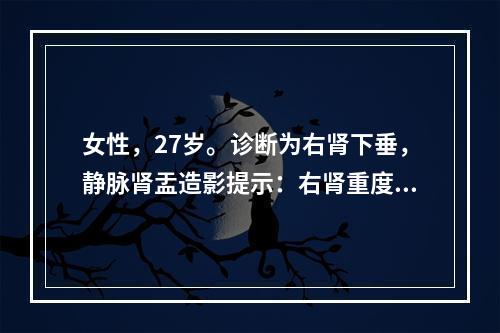 女性，27岁。诊断为右肾下垂，静脉肾盂造影提示：右肾重度积水