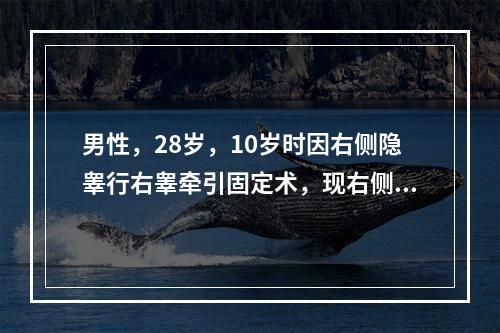 男性，28岁，10岁时因右侧隐睾行右睾牵引固定术，现右侧阴囊