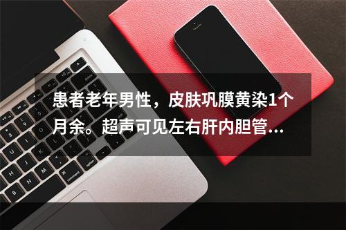 患者老年男性，皮肤巩膜黄染1个月余。超声可见左右肝内胆管显著