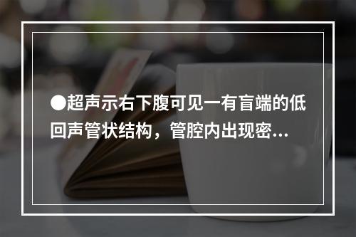 ●超声示右下腹可见一有盲端的低回声管状结构，管腔内出现密集点