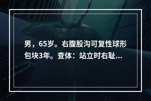 男，65岁。右腹股沟可复性球形包块3年。查体：站立时右耻骨结