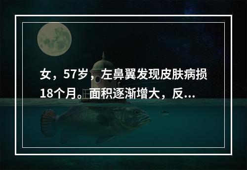 女，57岁，左鼻翼发现皮肤病损18个月。面积逐渐增大，反复出