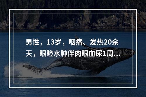 男性，13岁，咽痛、发热20余天，眼睑水肿伴肉眼血尿1周。入