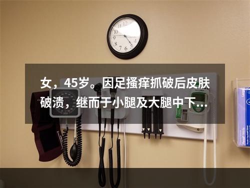 女，45岁。因足搔痒抓破后皮肤破溃，继而于小腿及大腿中下段出