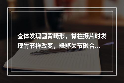 查体发现圆背畸形，脊柱摄片时发现竹节样改变，骶髂关节融合，应