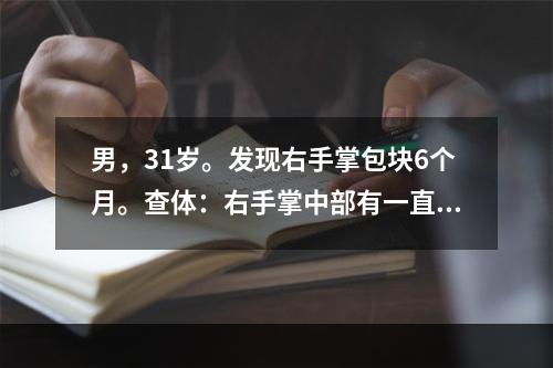 男，31岁。发现右手掌包块6个月。查体：右手掌中部有一直径为