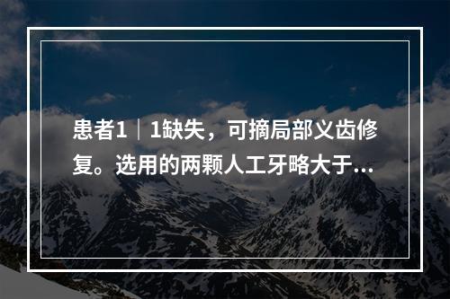 患者1｜1缺失，可摘局部义齿修复。选用的两颗人工牙略大于缺隙