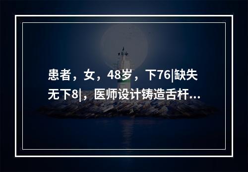 患者，女，48岁，下76|缺失无下8|，医师设计铸造舌杆连接