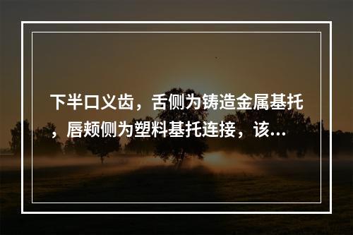 下半口义齿，舌侧为铸造金属基托，唇颊侧为塑料基托连接，该义齿