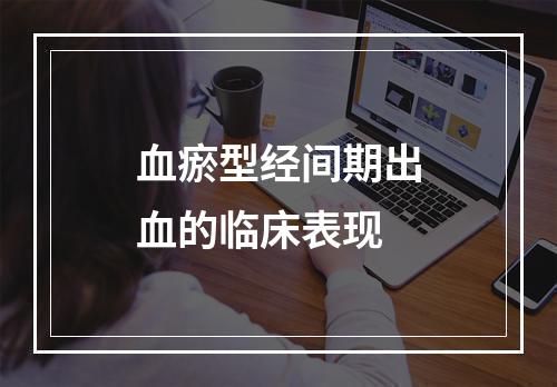 血瘀型经间期出血的临床表现