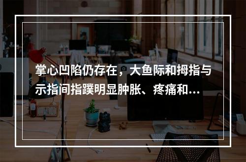 掌心凹陷仍存在，大鱼际和拇指与示指间指蹼明显肿胀、疼痛和压痛