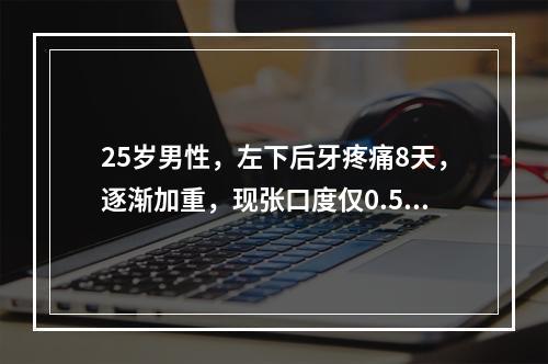 25岁男性，左下后牙疼痛8天，逐渐加重，现张口度仅0.5c