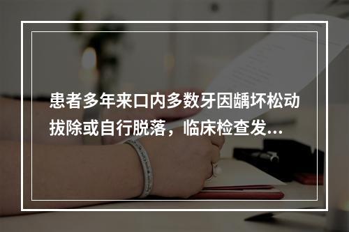 患者多年来口内多数牙因龋坏松动拔除或自行脱落，临床检查发现