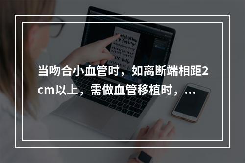 当吻合小血管时，如离断端相距2cm以上，需做血管移植时，最好