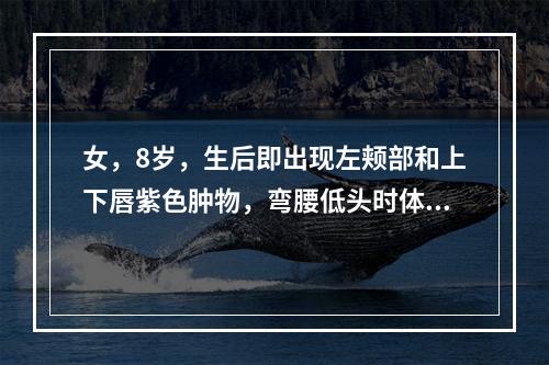 女，8岁，生后即出现左颊部和上下唇紫色肿物，弯腰低头时体积增