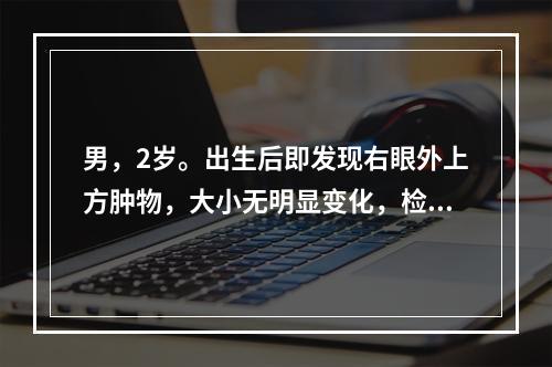 男，2岁。出生后即发现右眼外上方肿物，大小无明显变化，检查发