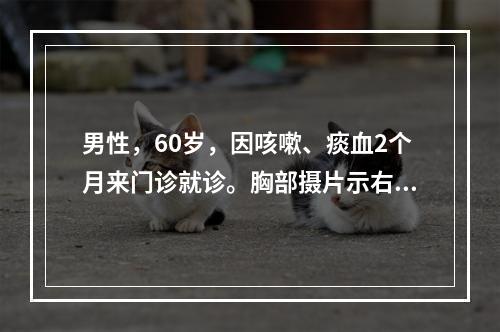 男性，60岁，因咳嗽、痰血2个月来门诊就诊。胸部摄片示右上叶