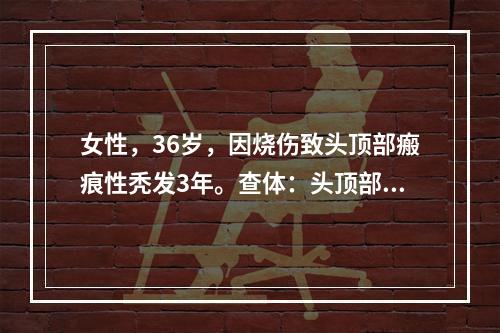 女性，36岁，因烧伤致头顶部瘢痕性秃发3年。查体：头顶部瘢痕