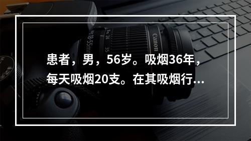 患者，男，56岁。吸烟36年，每天吸烟20支。在其吸烟行为的