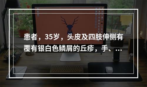 患者，35岁，头皮及四肢伸侧有覆有银白色鳞屑的丘疹，手、腕、