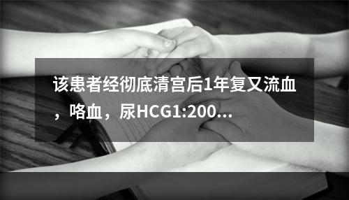 该患者经彻底清宫后1年复又流血，咯血，尿HCG1:200（+