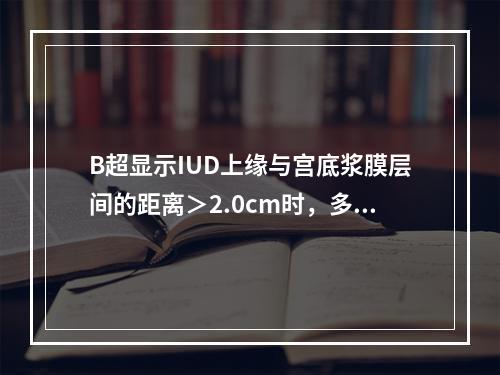 B超显示IUD上缘与宫底浆膜层间的距离＞2.0cm时，多提示