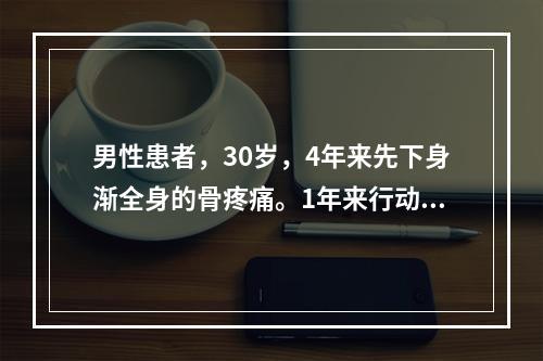 男性患者，30岁，4年来先下身渐全身的骨疼痛。1年来行动困难