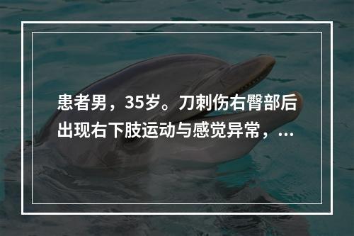 患者男，35岁。刀刺伤右臀部后出现右下肢运动与感觉异常，首先