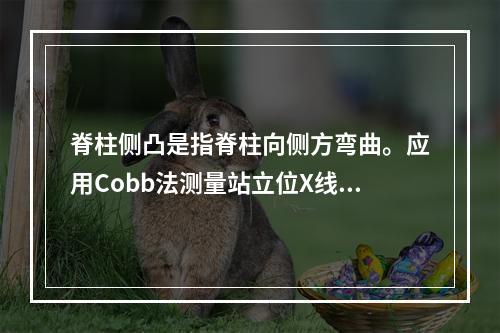 脊柱侧凸是指脊柱向侧方弯曲。应用Cobb法测量站立位X线片的