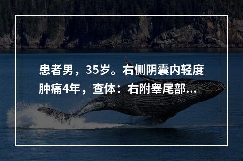 患者男，35岁。右侧阴囊内轻度肿痛4年，查体：右附睾尾部触及