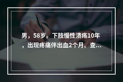 男，58岁。下肢慢性溃疡10年，出现疼痛伴出血2个月。查体：