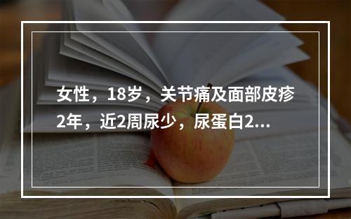 女性，18岁，关节痛及面部皮疹2年，近2周尿少，尿蛋白2.1