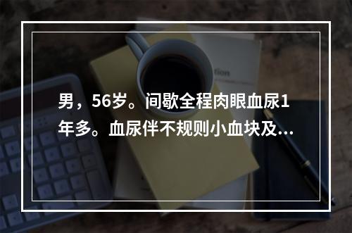 男，56岁。间歇全程肉眼血尿1年多。血尿伴不规则小血块及轻度