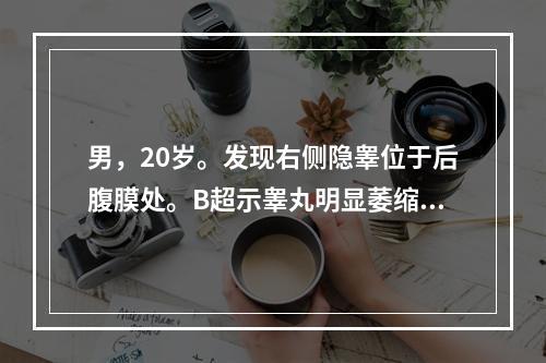 男，20岁。发现右侧隐睾位于后腹膜处。B超示睾丸明显萎缩变小